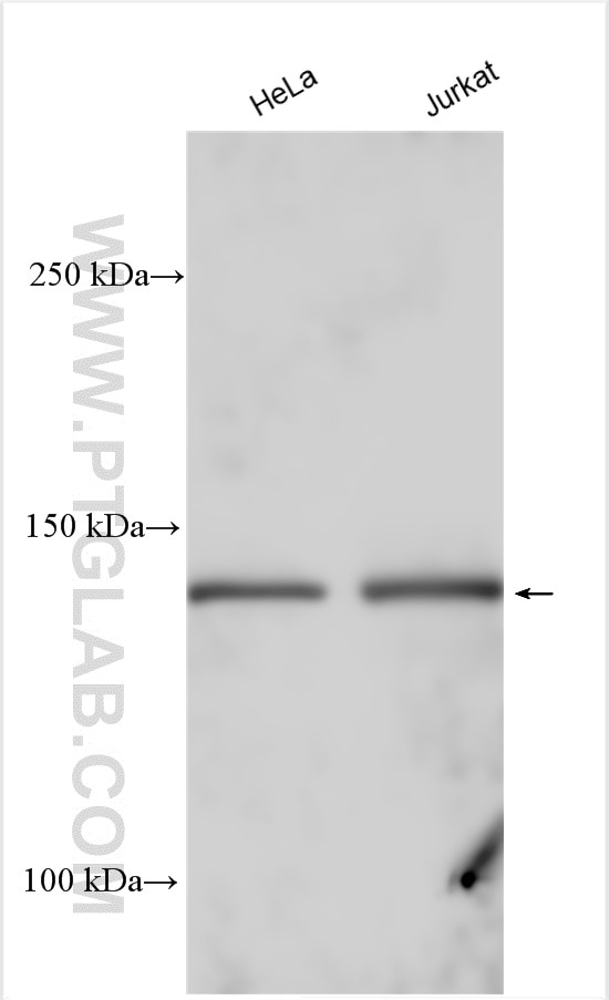 Western Blot (WB) analysis of various lysates using DHX9 Polyclonal antibody (17721-1-AP)