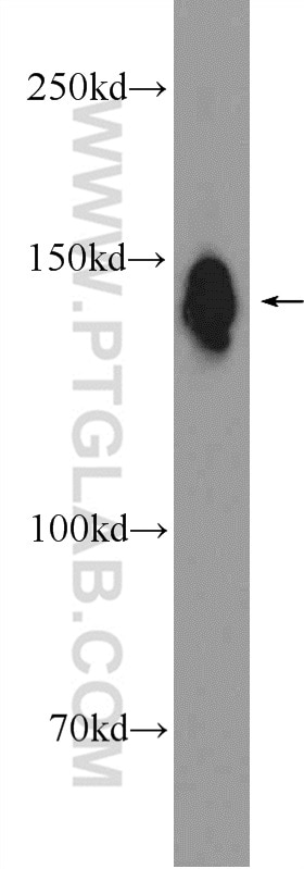 Western Blot (WB) analysis of rat spleen tissue using DHX9 Polyclonal antibody (17721-1-AP)