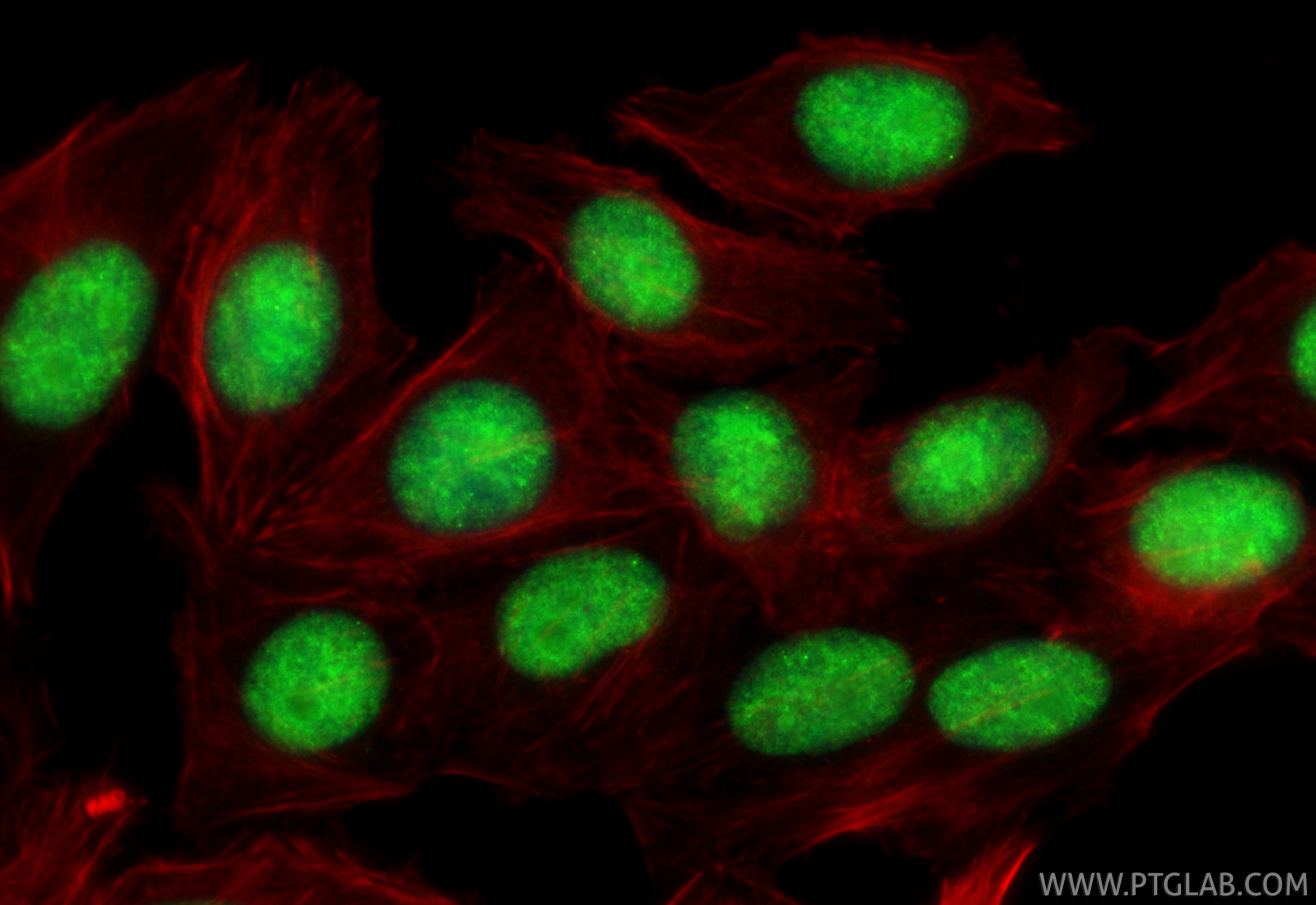 IF Staining of HepG2 using 67153-1-Ig Immunofluorescence (IF) / fluorescent staining of HepG2 cells using DHX9 Monoclonal antibody (67153-1-Ig)