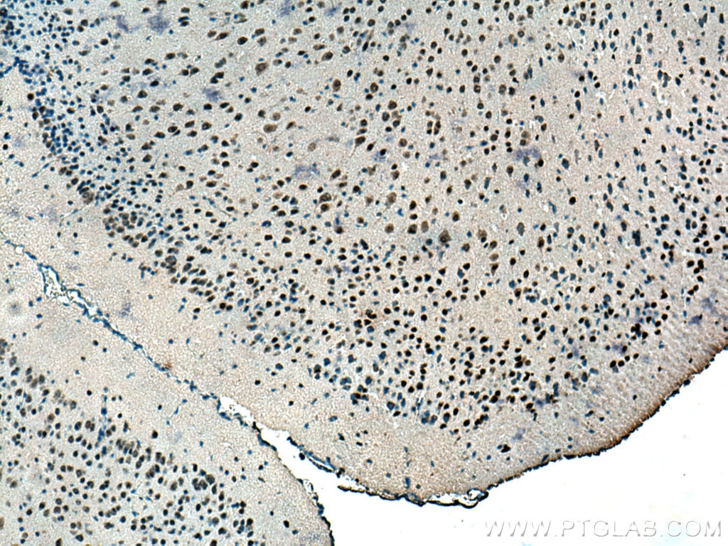 Immunohistochemistry (IHC) staining of mouse brain tissue using DHX9 Monoclonal antibody (67153-1-Ig)