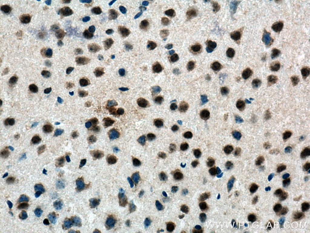 Immunohistochemistry (IHC) staining of mouse brain tissue using DHX9 Monoclonal antibody (67153-1-Ig)