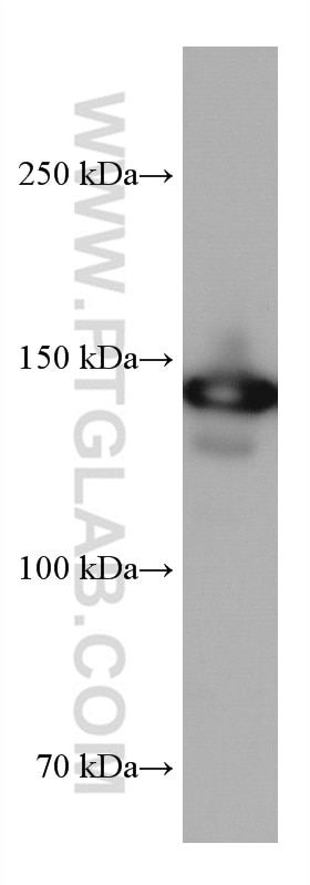 Western Blot (WB) analysis of HepG2 cells using DHX9 Monoclonal antibody (67153-1-Ig)