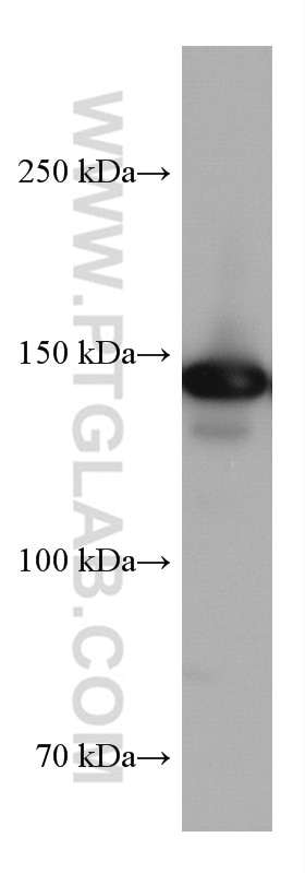 Western Blot (WB) analysis of HEK-293 cells using DHX9 Monoclonal antibody (67153-1-Ig)