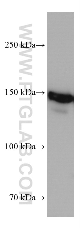 Western Blot (WB) analysis of HeLa cells using DHX9 Monoclonal antibody (67153-1-Ig)