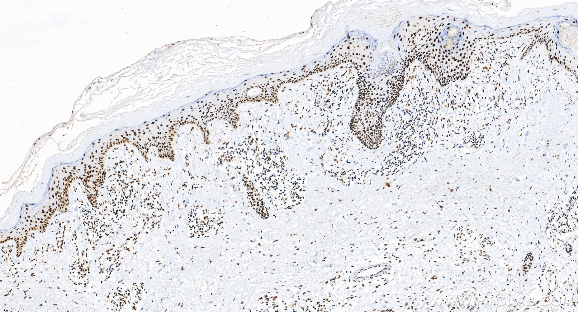 IHC staining of human skin using 88165-1-RR (same clone as 88165-1-PBS) Immunohistochemistry (IHC) staining of human skin tissue using DHX9 Recombinant monoclonal antibody (88165-1-RR)