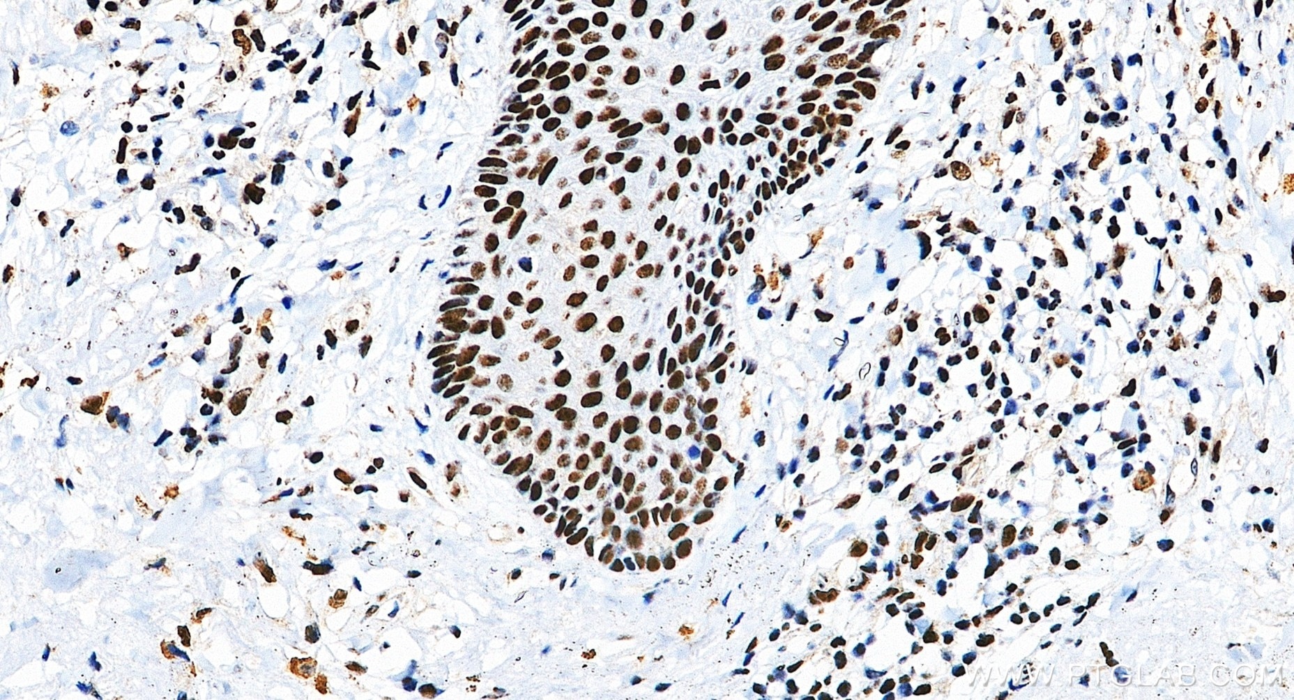 IHC staining of human skin using 88165-1-RR (same clone as 88165-1-PBS) Immunohistochemistry (IHC) staining of human skin tissue using DHX9 Recombinant monoclonal antibody (88165-1-RR)