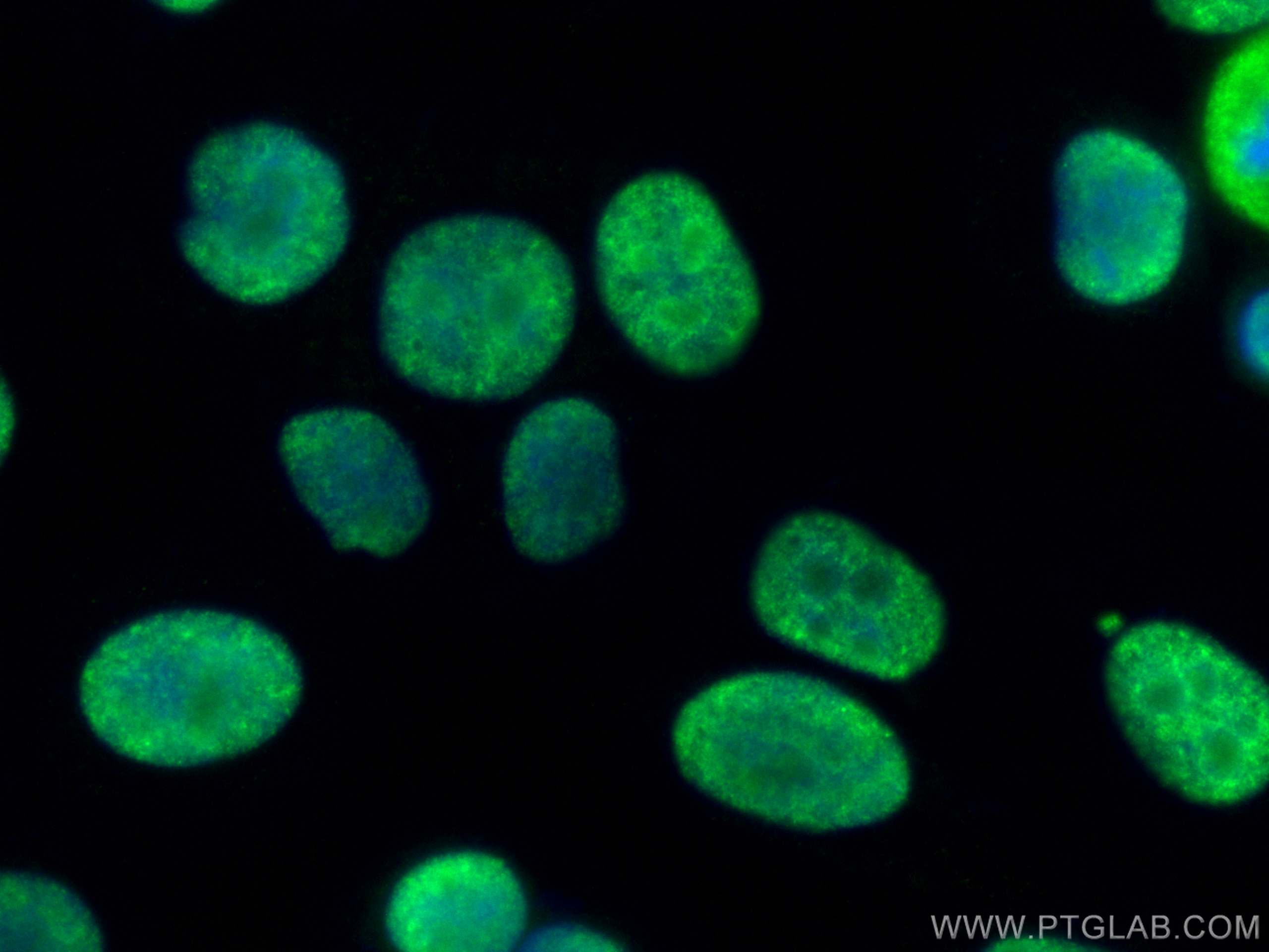 Immunofluorescence (IF) / fluorescent staining of HepG2 cells using CoraLite® Plus 488-conjugated DHX9 Polyclonal anti (CL488-17721)