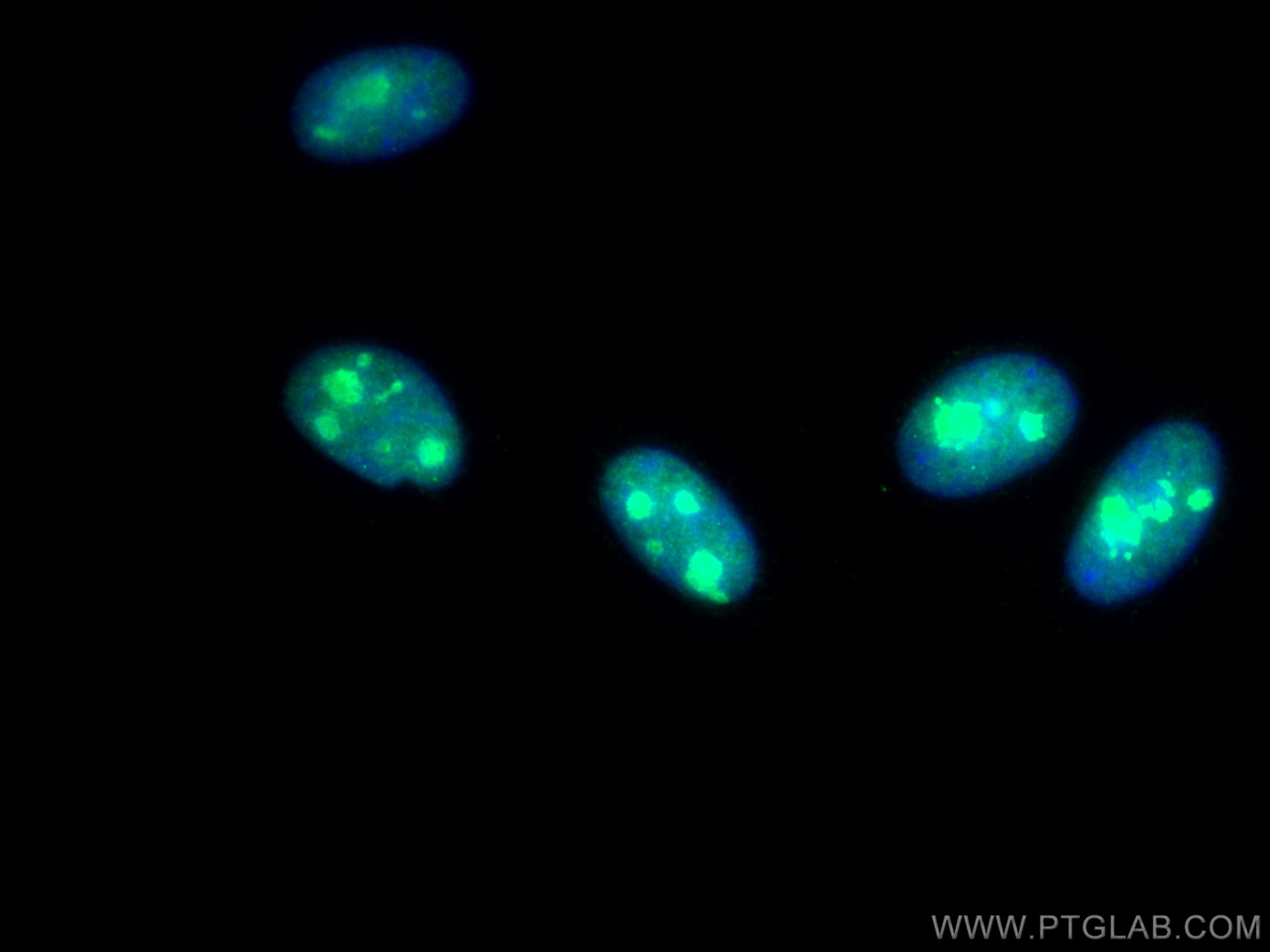 Immunofluorescence (IF) / fluorescent staining of HepG2 cells using CoraLite® Plus 488-conjugated DHX9 Monoclonal anti (CL488-67153)