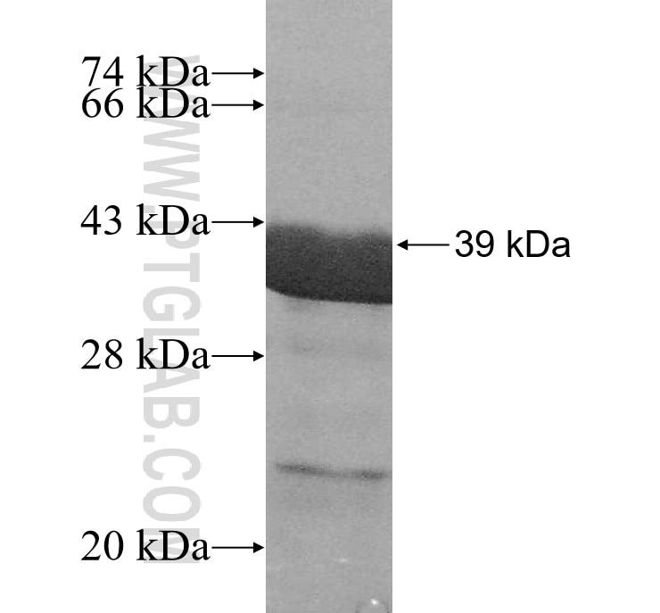 DHX9 fusion protein Ag12104 SDS-PAGE