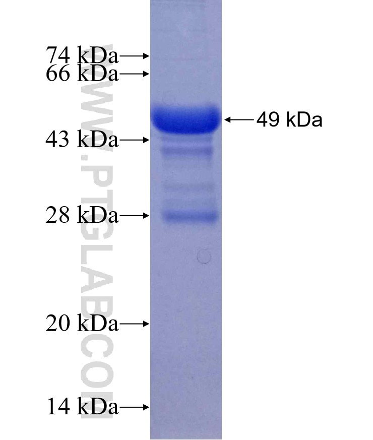 DHX9 fusion protein Ag12807 SDS-PAGE