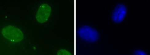DHX9 antibody (mAb) (Clone 8E3) tested by Immunofluorescence. Left: Formaldehyde fixed L929 cells stained with DHX9 antibody (mAb). Right: Hoechst.