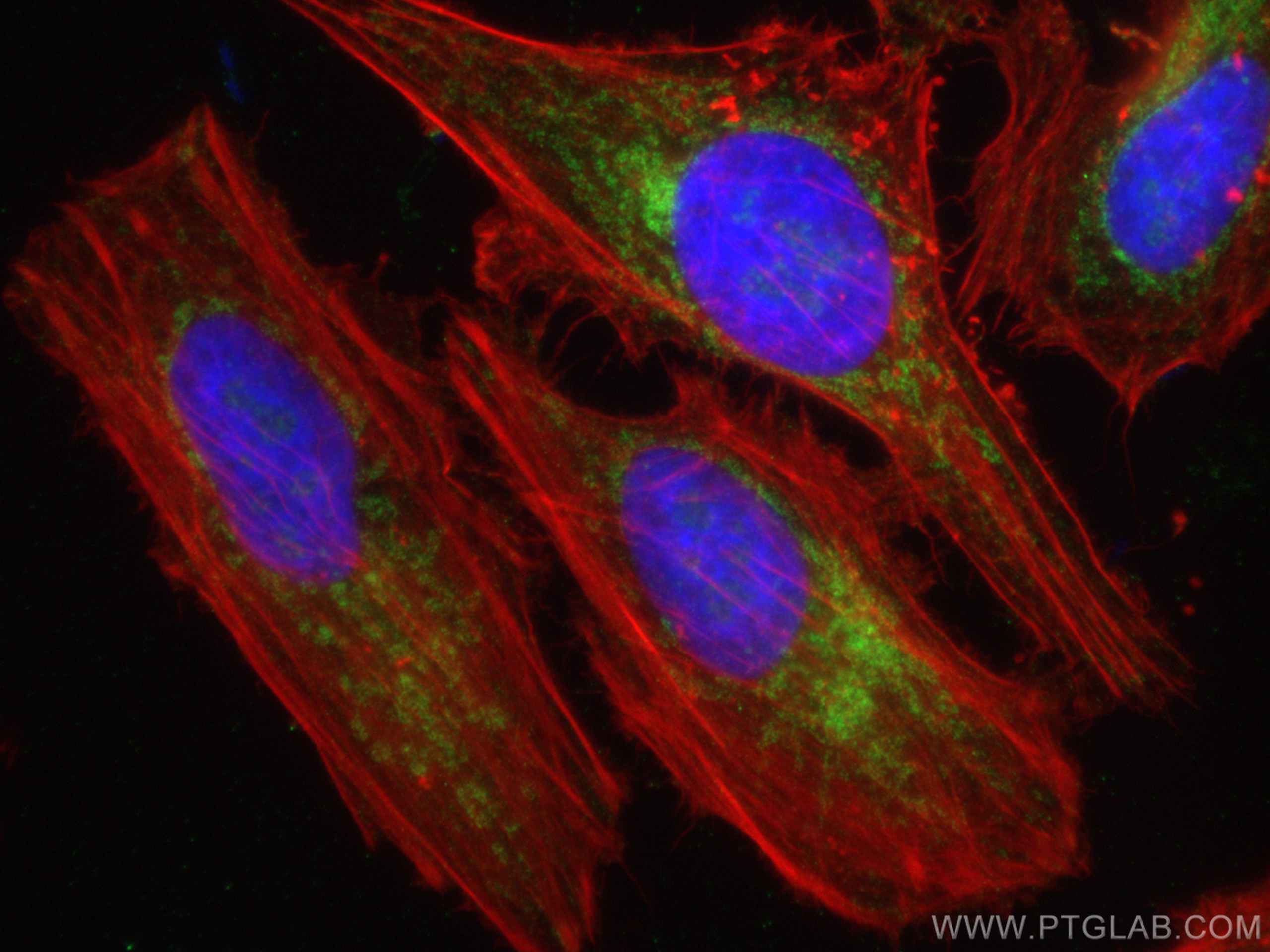 Immunofluorescence (IF) / fluorescent staining of HeLa cells using DIABLO Polyclonal antibody (10434-1-AP)