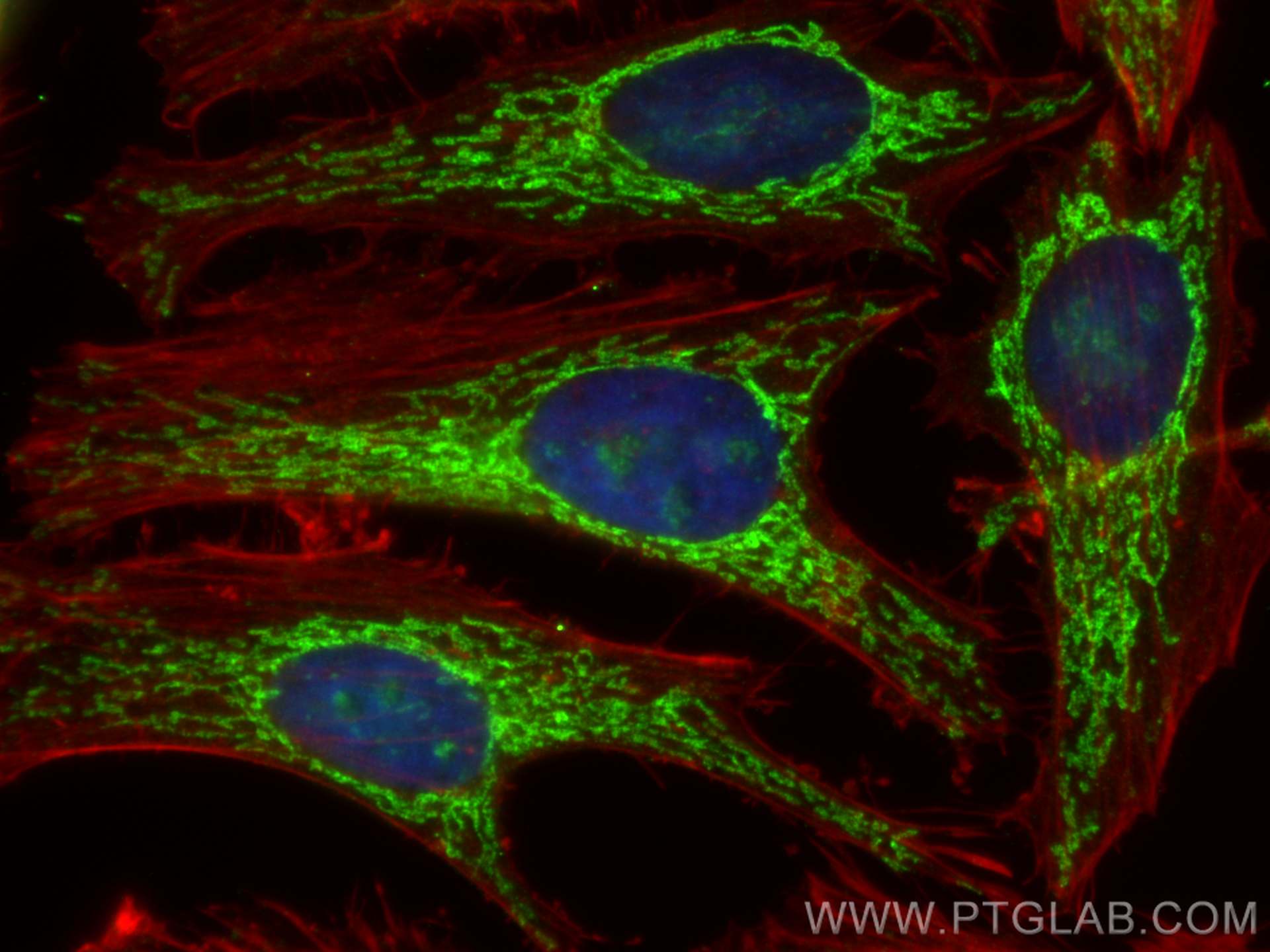 Immunofluorescence (IF) / fluorescent staining of HeLa cells using DIABLO Polyclonal antibody (10434-1-AP)