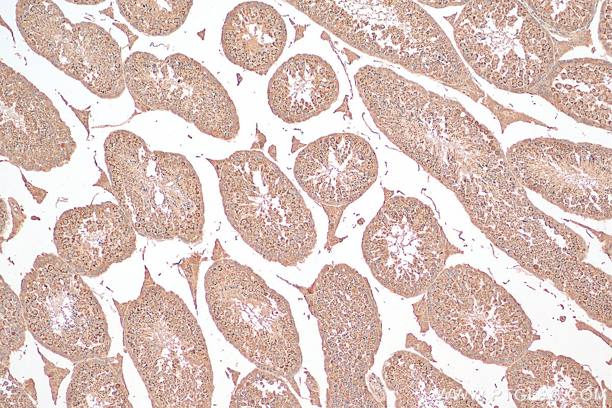 Immunohistochemistry (IHC) staining of mouse testis tissue using DIABLO Polyclonal antibody (10434-1-AP)