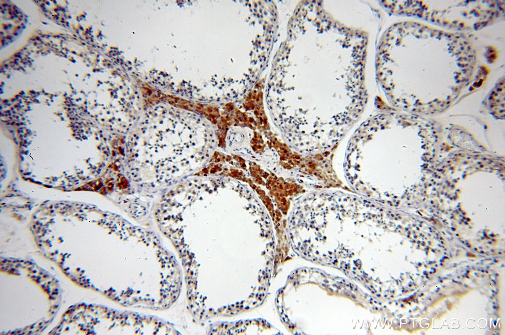 Immunohistochemistry (IHC) staining of human testis tissue using DIABLO Polyclonal antibody (10434-1-AP)