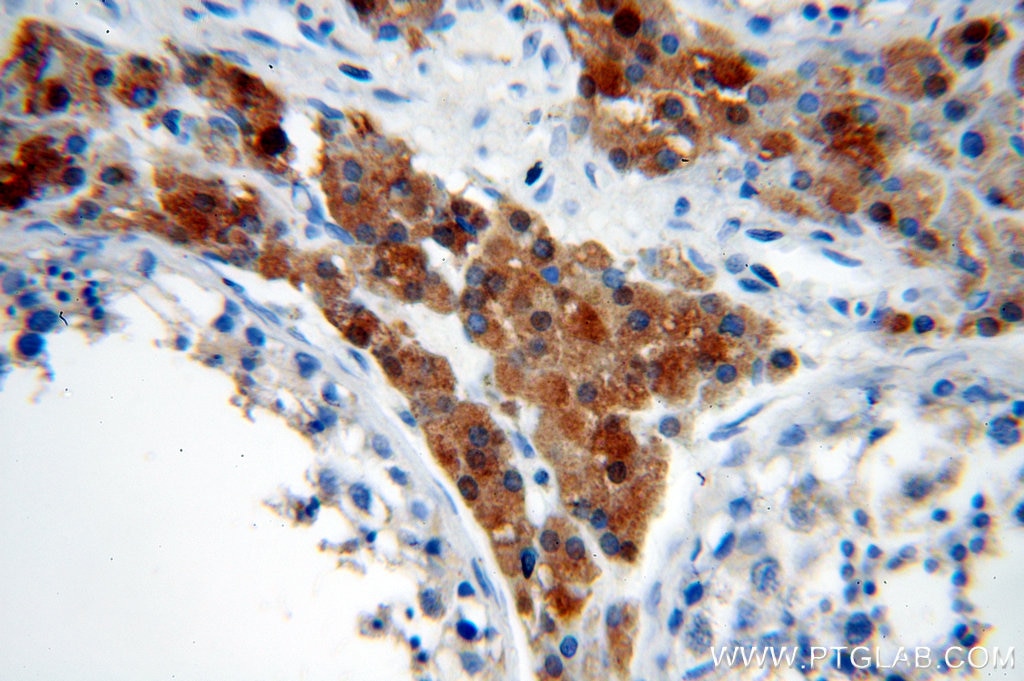 Immunohistochemistry (IHC) staining of human testis tissue using DIABLO Polyclonal antibody (10434-1-AP)