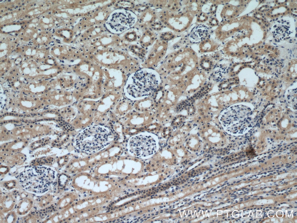 Immunohistochemistry (IHC) staining of human kidney tissue using DIABLO Polyclonal antibody (10434-1-AP)