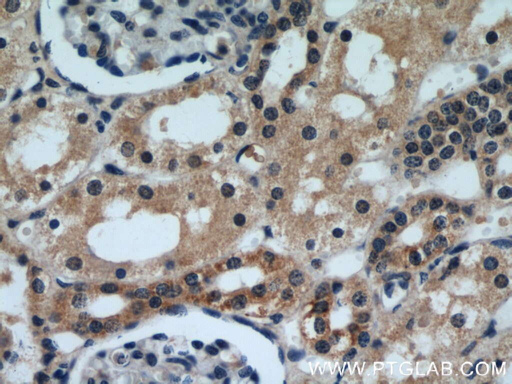 Immunohistochemistry (IHC) staining of human kidney tissue using DIABLO Polyclonal antibody (10434-1-AP)