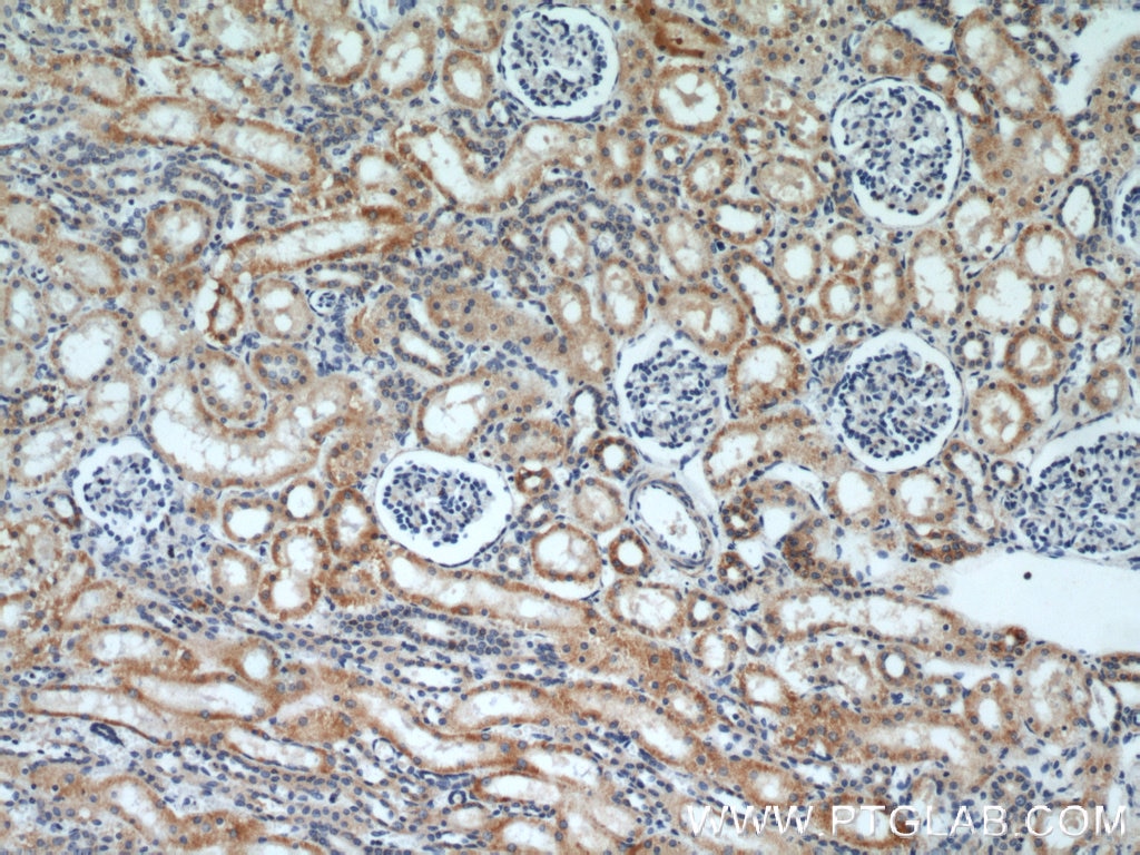 Immunohistochemistry (IHC) staining of human kidney tissue using DIABLO Polyclonal antibody (10434-1-AP)