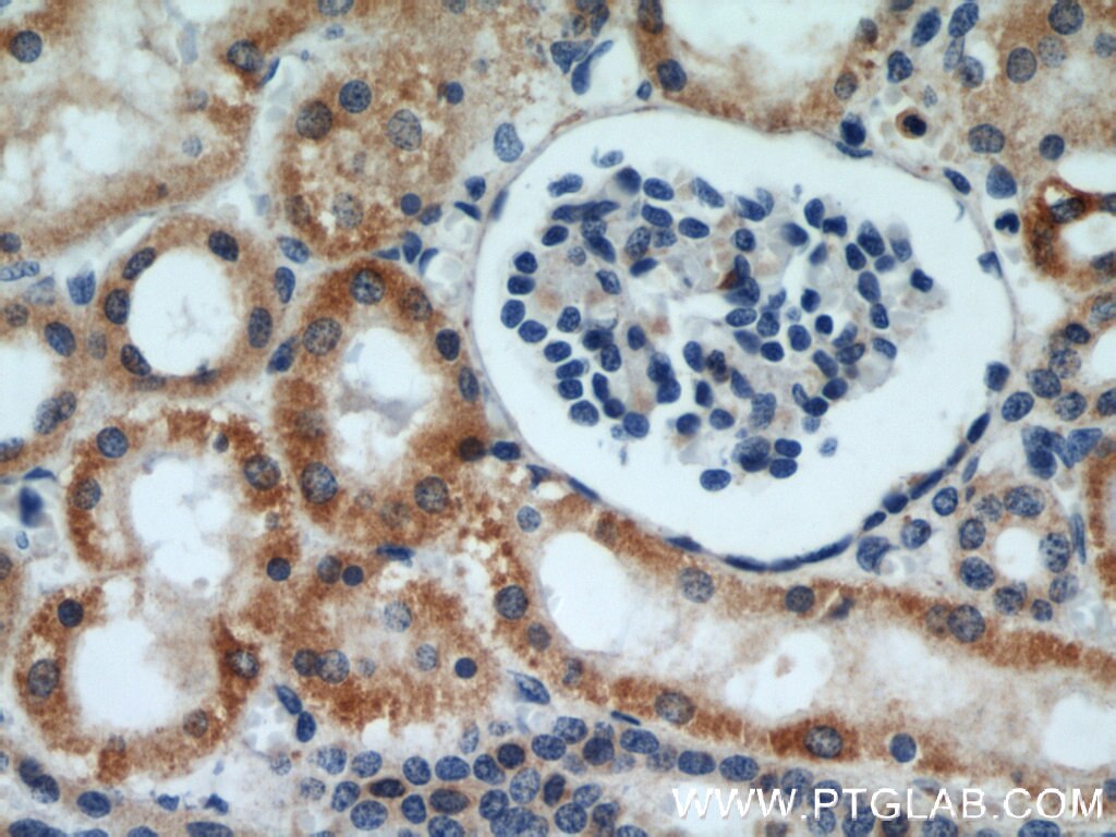 Immunohistochemistry (IHC) staining of human kidney tissue using DIABLO Polyclonal antibody (10434-1-AP)