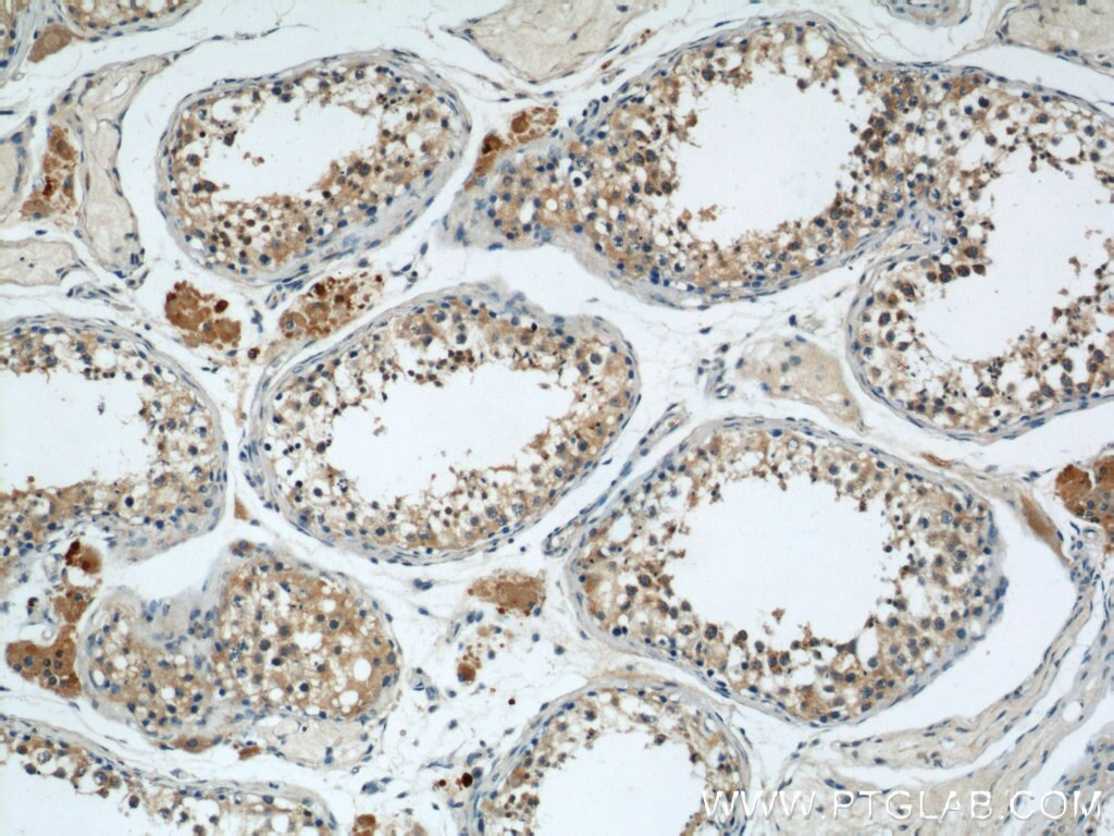 Immunohistochemistry (IHC) staining of human testis tissue using DIABLO Polyclonal antibody (10434-1-AP)