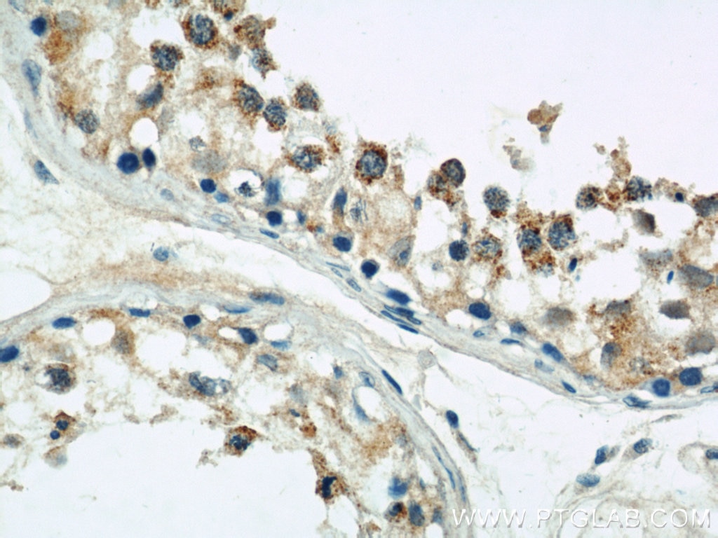 Immunohistochemistry (IHC) staining of human testis tissue using DIABLO Polyclonal antibody (10434-1-AP)