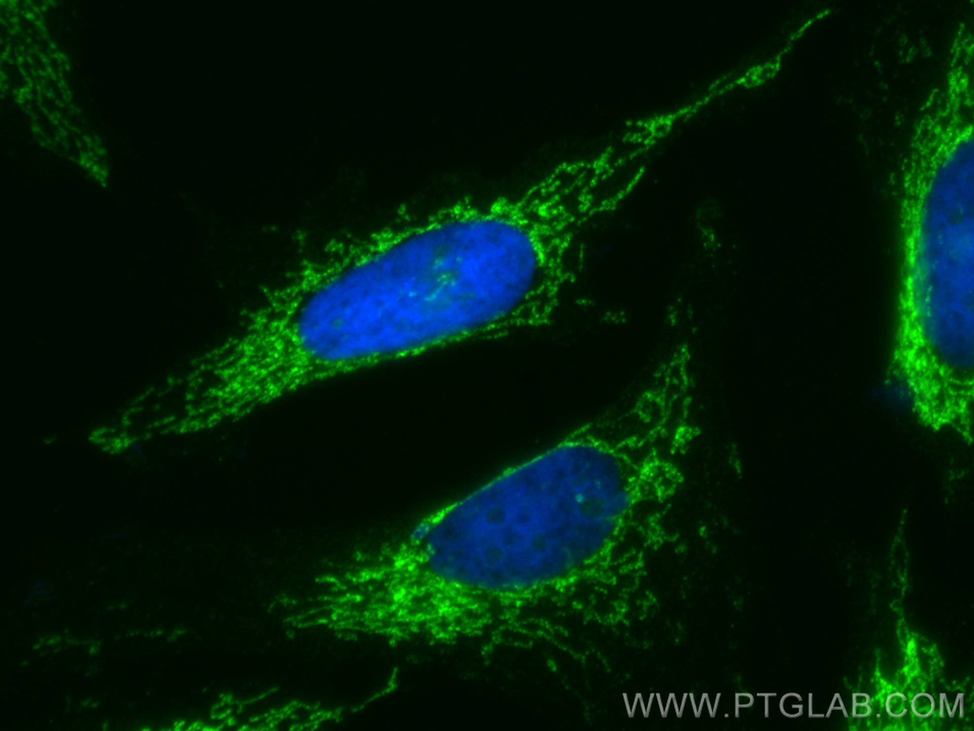 Immunofluorescence (IF) / fluorescent staining of HeLa cells using CoraLite® Plus 488-conjugated DIABLO Polyclonal an (CL488-10434)