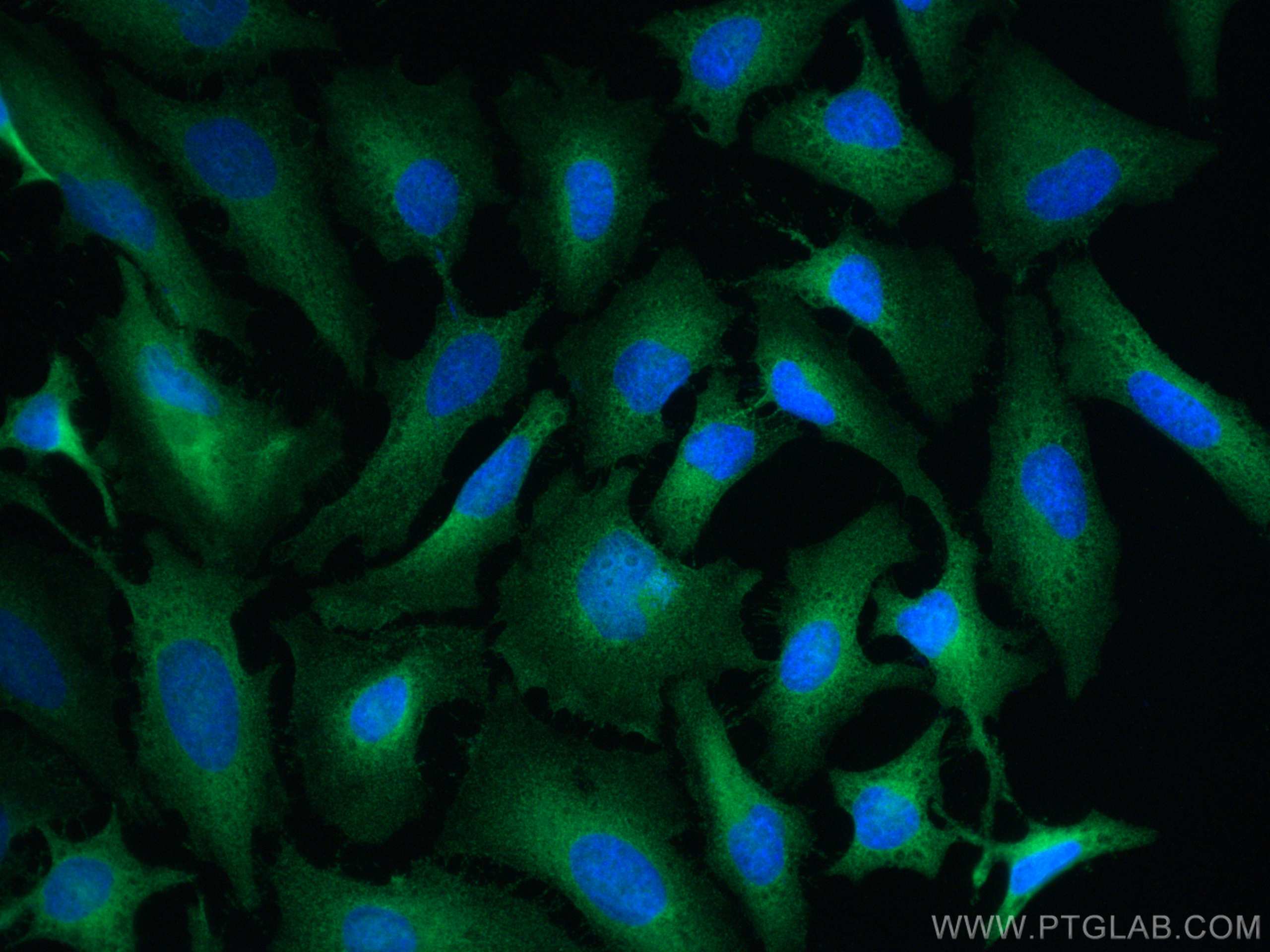 Immunofluorescence (IF) / fluorescent staining of HeLa cells using mDia1 Polyclonal antibody (20624-1-AP)