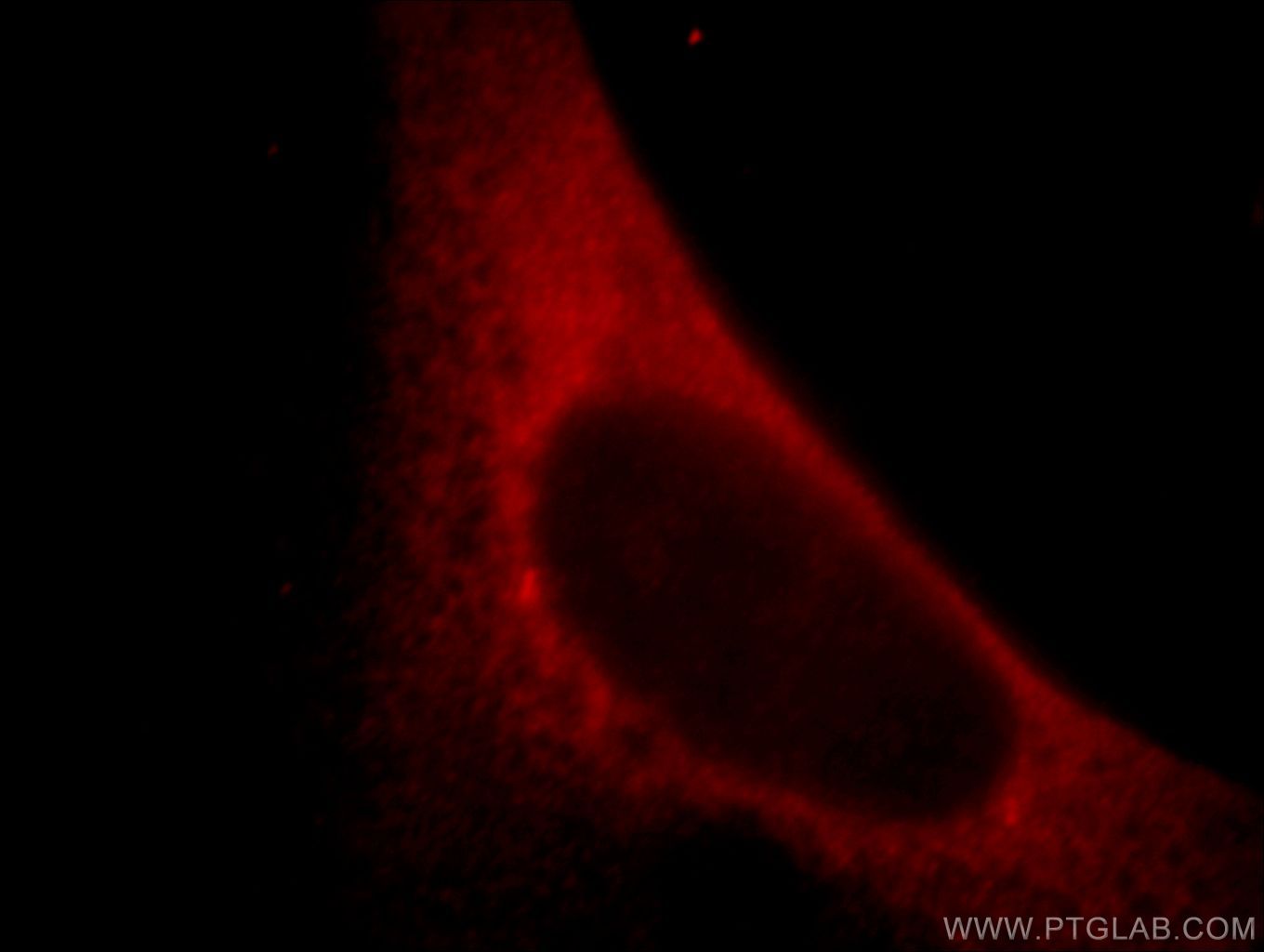 Immunofluorescence (IF) / fluorescent staining of HeLa cells using mDia1 Polyclonal antibody (20624-1-AP)