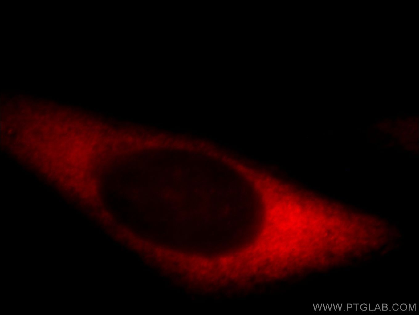 Immunofluorescence (IF) / fluorescent staining of HepG2 cells using mDia1 Polyclonal antibody (20624-1-AP)