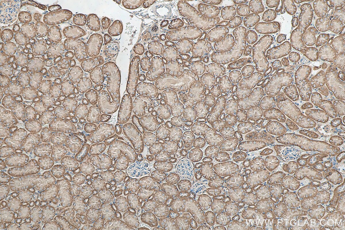 Immunohistochemistry (IHC) staining of mouse kidney tissue using mDia1 Polyclonal antibody (20624-1-AP)