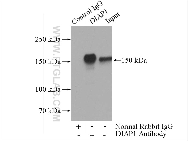 Immunoprecipitation (IP) experiment of HeLa cells using mDia1 Polyclonal antibody (20624-1-AP)