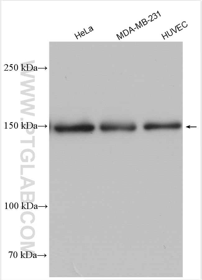 Western Blot (WB) analysis of various lysates using mDia1 Polyclonal antibody (20624-1-AP)