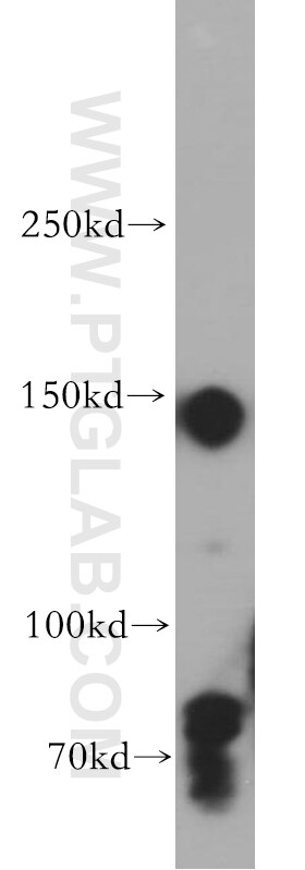 Western Blot (WB) analysis of human heart tissue using mDia1 Polyclonal antibody (20624-1-AP)