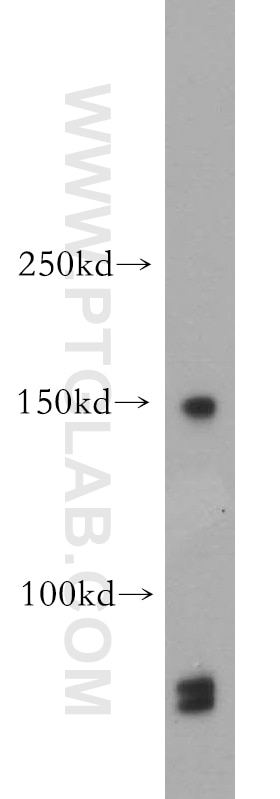 Western Blot (WB) analysis of human skeletal muscle tissue using mDia1 Polyclonal antibody (20624-1-AP)