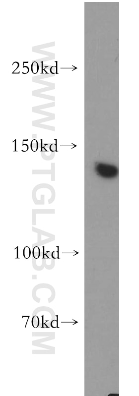 Western Blot (WB) analysis of COS-7 cells using mDia1 Polyclonal antibody (20624-1-AP)