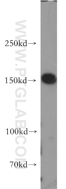 Western Blot (WB) analysis of NIH/3T3 cells using mDia1 Polyclonal antibody (20624-1-AP)