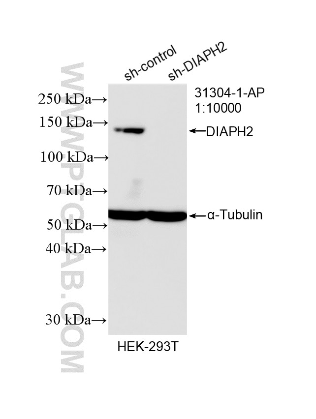 Western Blot (WB) analysis of HEK-293T cells using DIAPH2 Polyclonal antibody (31304-1-AP)