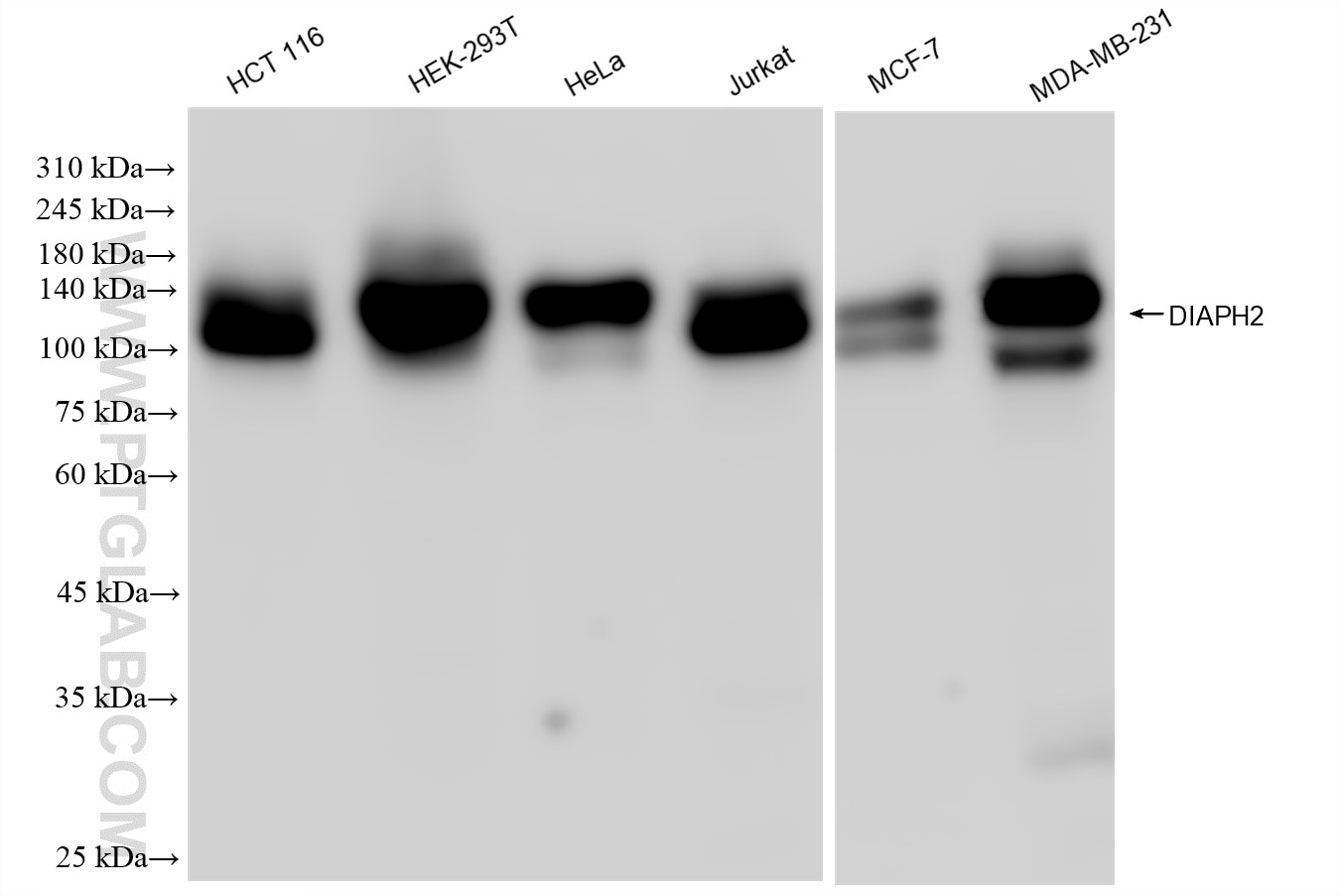 Western Blot (WB) analysis of various lysates using DIAPH2 Recombinant antibody (84671-4-RR)