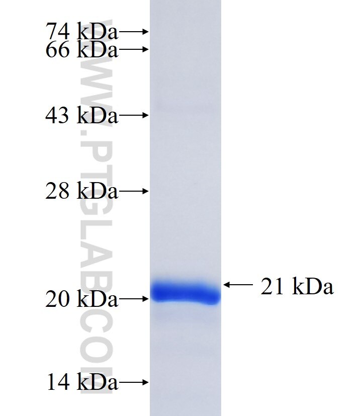 DIAPH2 fusion protein Ag35322 SDS-PAGE