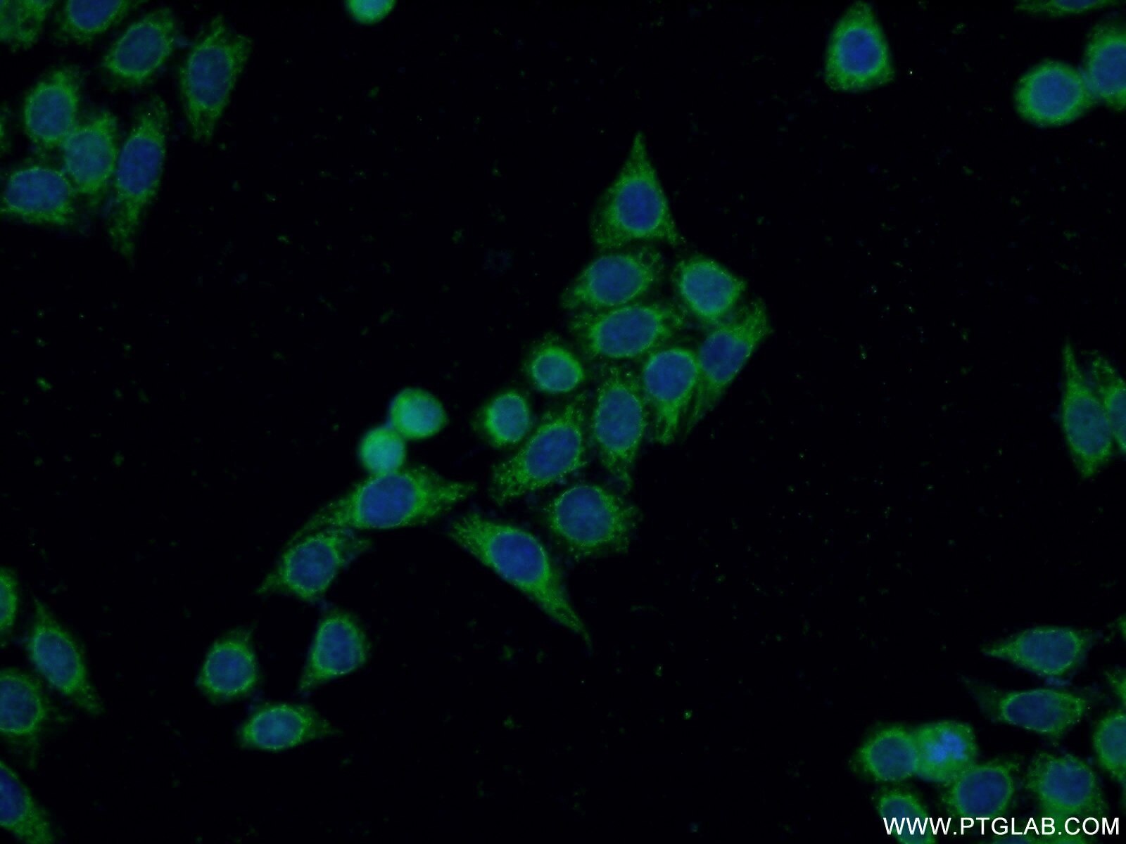 IF Staining of HeLa using 14342-1-AP