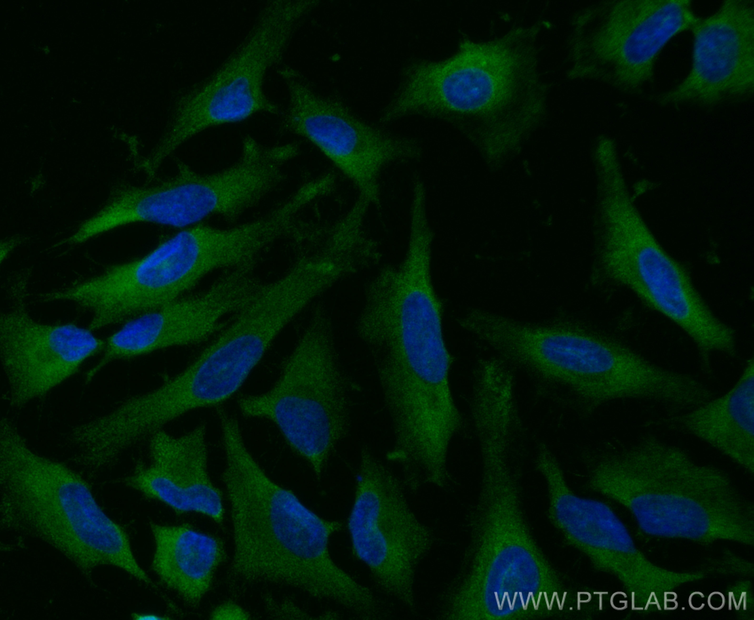 Immunofluorescence (IF) / fluorescent staining of HeLa cells using DIAPH3 Polyclonal antibody (14342-1-AP)