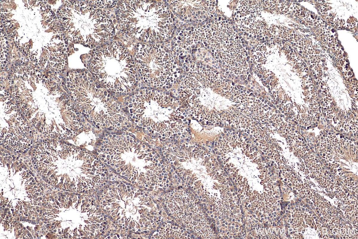 Immunohistochemistry (IHC) staining of mouse testis tissue using DIAPH3 Polyclonal antibody (14342-1-AP)