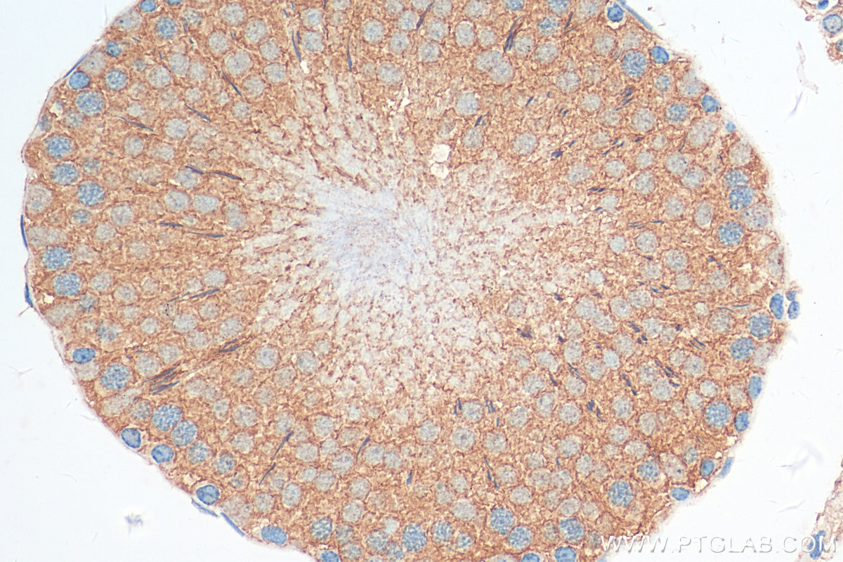 Immunohistochemistry (IHC) staining of rat testis tissue using DIAPH3 Polyclonal antibody (14342-1-AP)
