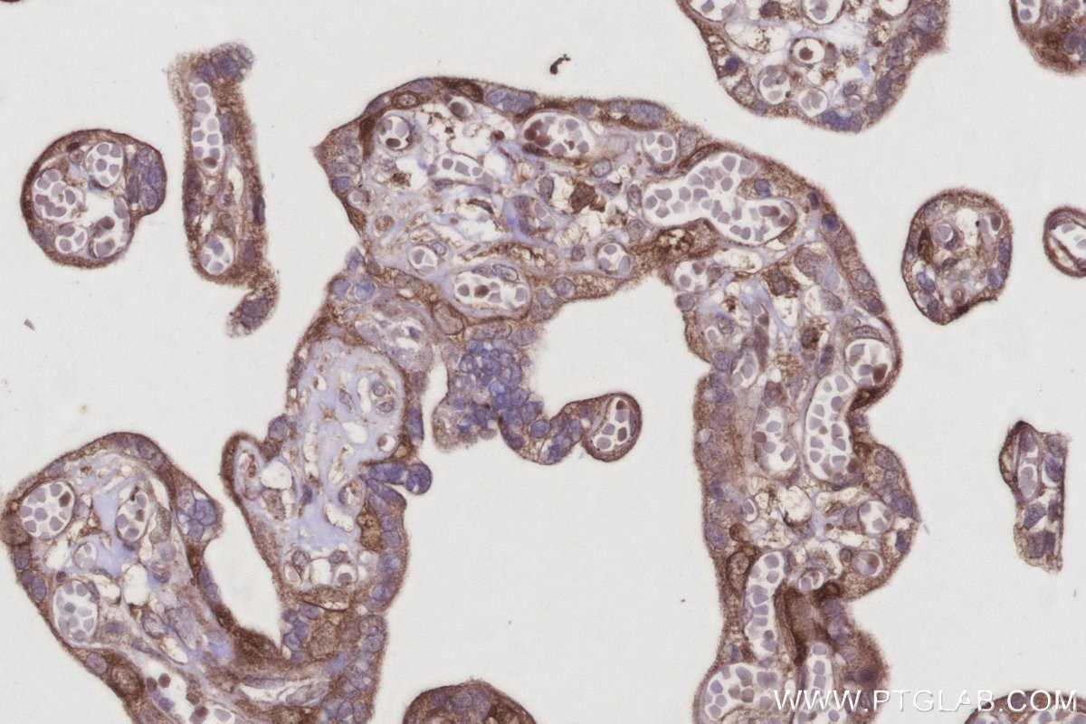 Immunohistochemistry (IHC) staining of human placenta tissue using DIAPH3 Polyclonal antibody (14342-1-AP)