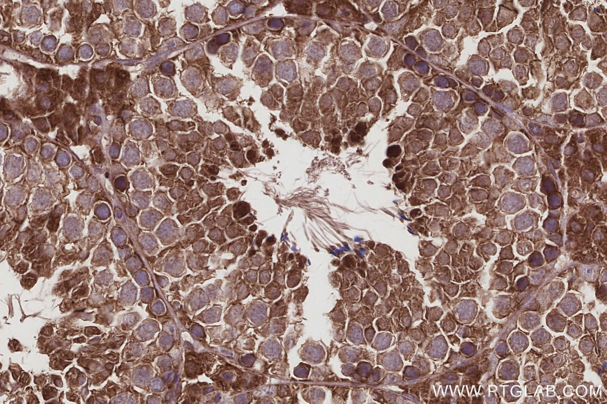 Immunohistochemistry (IHC) staining of mouse testis tissue using DIAPH3 Polyclonal antibody (14342-1-AP)