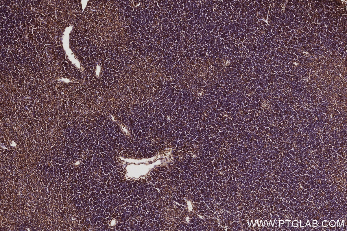 Immunohistochemistry (IHC) staining of mouse thymus tissue using DIAPH3 Polyclonal antibody (14342-1-AP)