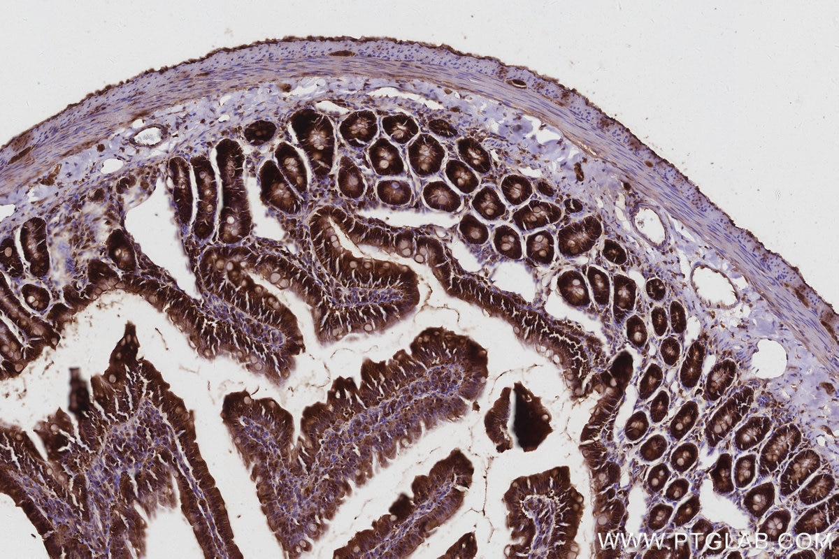 Immunohistochemistry (IHC) staining of rat small intestine tissue using DIAPH3 Polyclonal antibody (14342-1-AP)