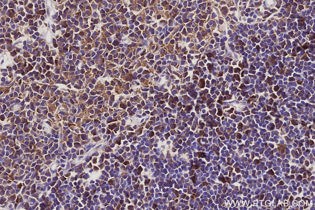Immunohistochemistry (IHC) staining of rat thymus tissue using DIAPH3 Polyclonal antibody (14342-1-AP)
