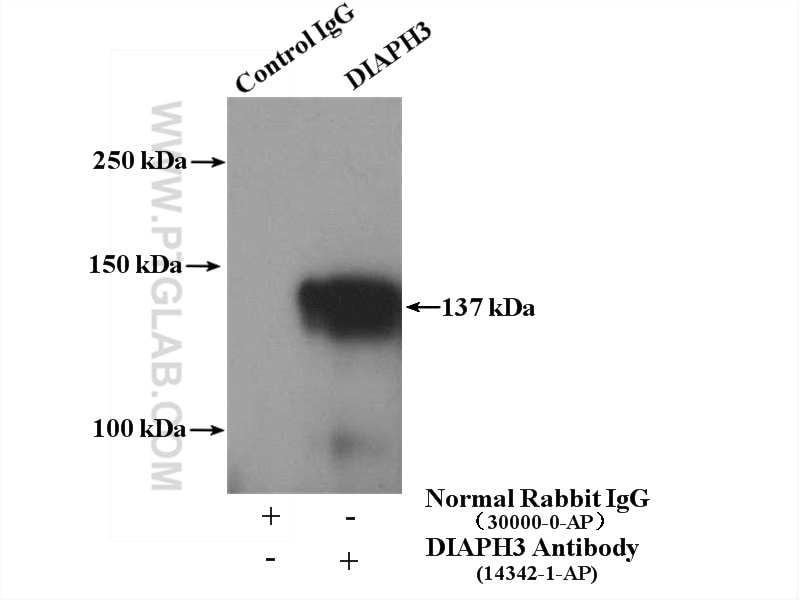 Immunoprecipitation (IP) experiment of HeLa cells using DIAPH3 Polyclonal antibody (14342-1-AP)